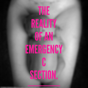 emergency c section